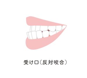 札幌　歯列矯正