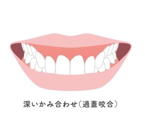 札幌　歯列矯正