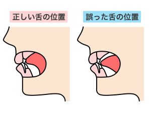 口元　舌の位置