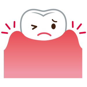 歯茎腫れる　歯周病