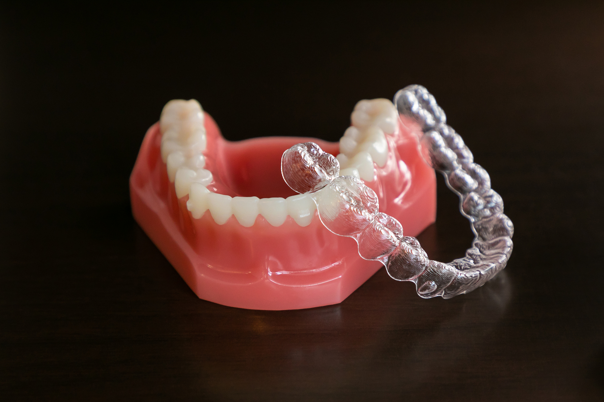 歯並びが整ってもメンテナンスしないといけないの？ | 札幌キュア矯正歯科