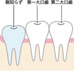 札幌　歯列矯正