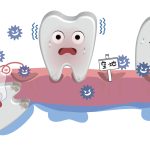 歯並び　歯周病