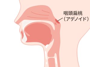 咽頭扁桃
