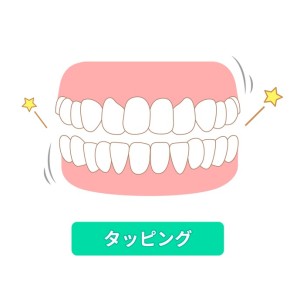 タッピング