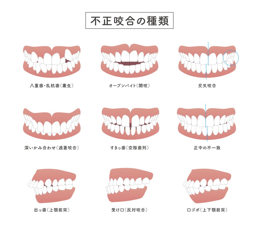 歯並び