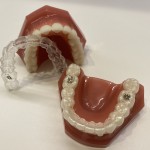 マウスピース　マウスピース矯正　模型
