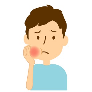 抜歯　腫れ　男性